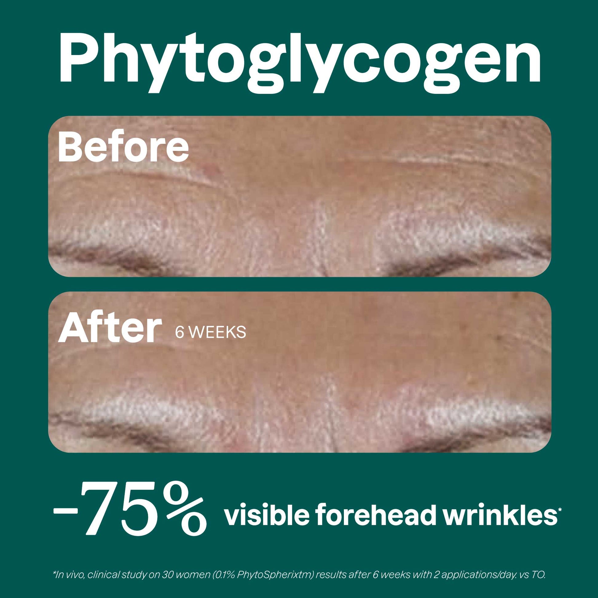Phytoglycogen-Before-after_en?