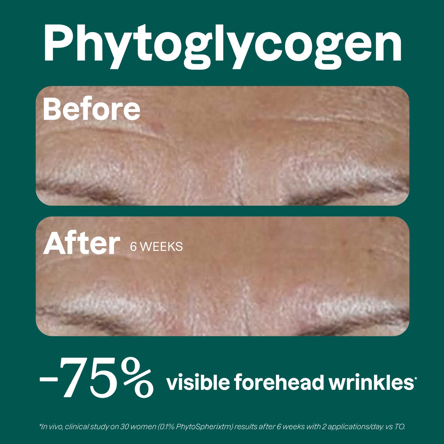 Phytoglycogen Before after en?